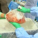 Donación de órganos en Panamá enfrenta una brecha