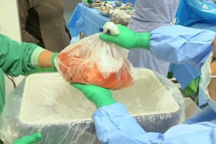 Donación de órganos en Panamá enfrenta una brecha